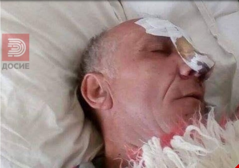 Осудениот за напад на Села, кој од тепање се распаѓаше во болница, Филипче го спасува од смрт