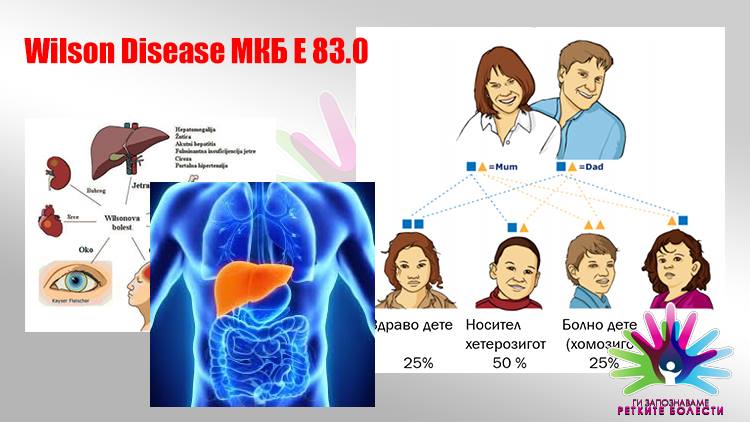 Што е Вилсонова болест?