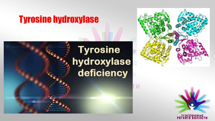 Што е дефицит на тирозин хидроксилаза?