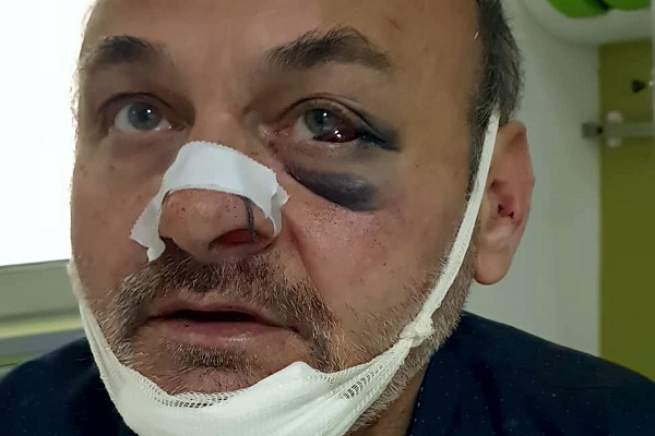 Тепачка во центарот на Скопје: Познат бизнисмен крвнички истепал сопственик на менувачница