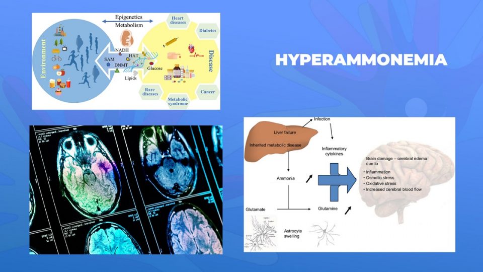 Ги запознаваме ретките болести: Хиперамонемија