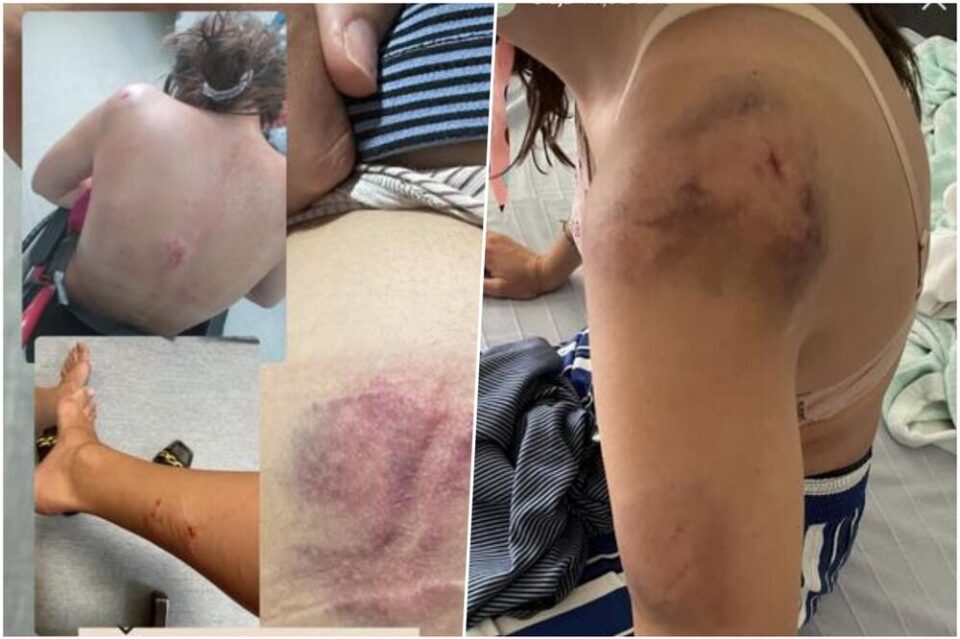 Модрици и рани остави градот врз девојка од Србија, возилото е уништено во неколку минути